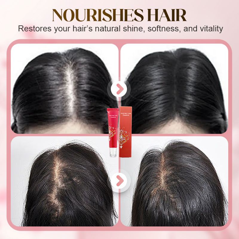 🌿✨ Esencia Herbaria Anticaída con Aplicador de Bola 💆‍♀️💚 Fortalece el Cabello • Estimula el Crecimiento • Cuidado Natural del Cuero Cabelludo 🌱💫