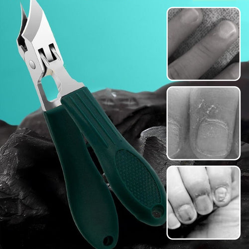 ⏰🔥 ¡50% DE DESCUENTO POR TIEMPO LIMITADO! ✂️ Cortaúñas Antisalpicaduras 25° – Precisión y Seguridad en Casa 🌿✨