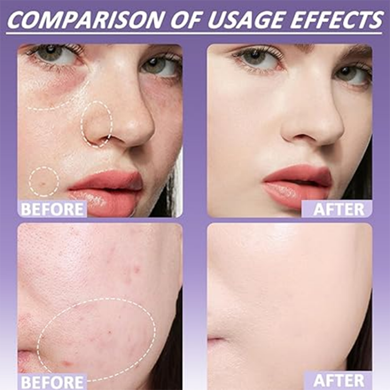 ✨💄 ¡50% DE DESCUENTO! Corrector Mate para Rostro y Cuerpo 🔥 Compra Más y Ahorra Más | Cobertura Perfecta Todo el Día 💖