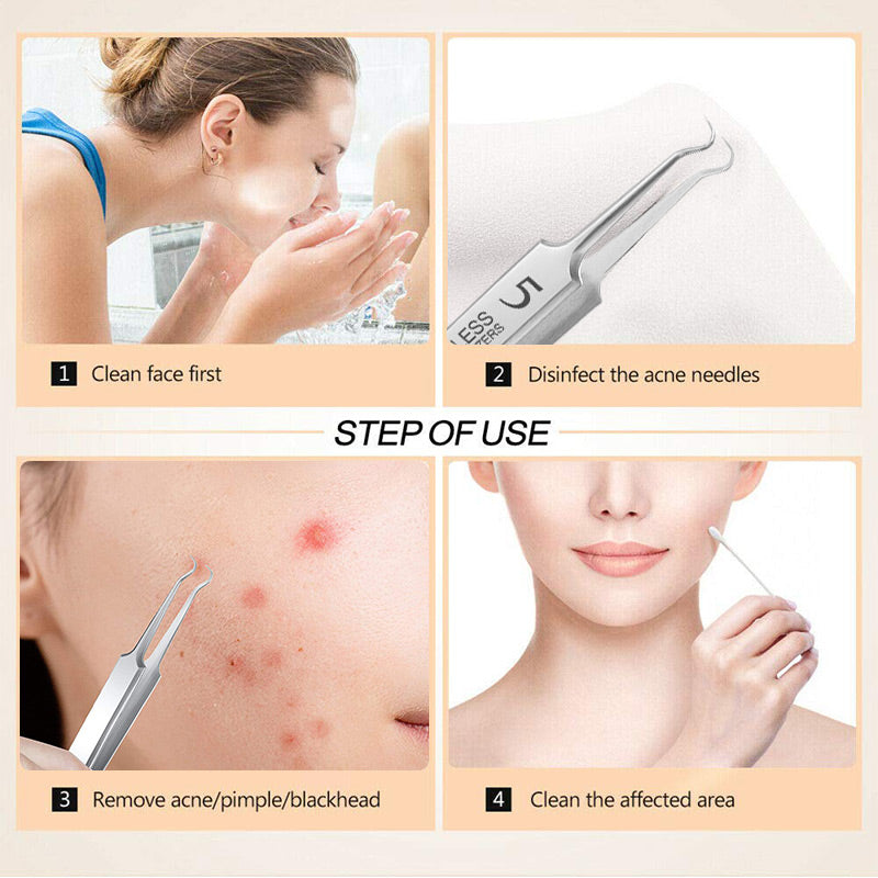 ✨🔥 Pinzas Extractoras de Puntos Negros de Acero Inoxidable 🖤💎 Precisas y seguras para una piel limpia y radiante 🌟🧖‍♀️