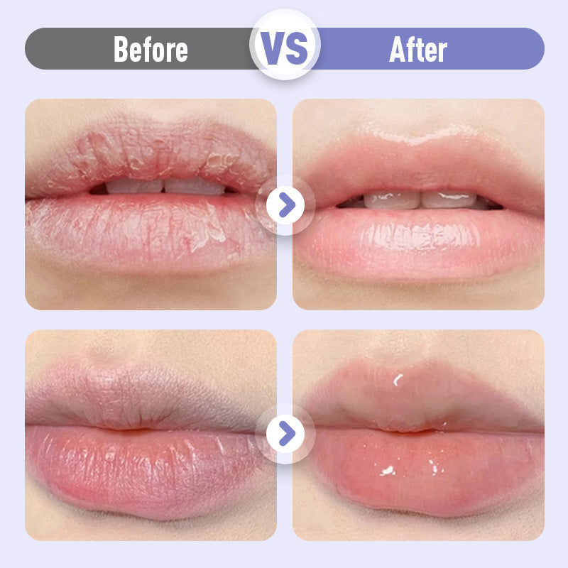 🔥COMPRAR 1 OBTENER 1 GRATIS🔥|Suero labial hidratante antiarrugas y voluminizador💧💋