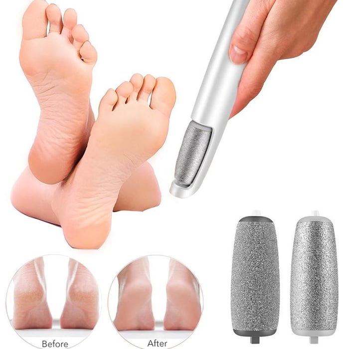 ⏰ ¡Oferta Limitada 50% OFF! 🦶 Removedor Eléctrico de Callos – Pies Suaves y Renovados en Minutos, Fácil y Seguro ✨💖