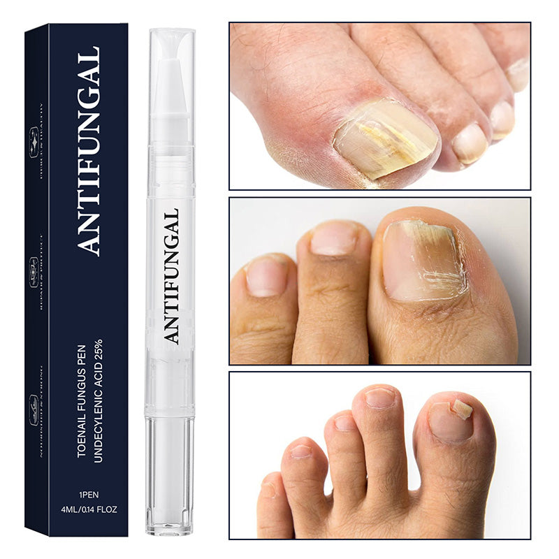 😫 Uñas Amarillas? Lápiz Restaurador, ¡90% Menos Decoloración! ⏳🛡️ 80% Menos Roturas+💧 72h Hidratación!