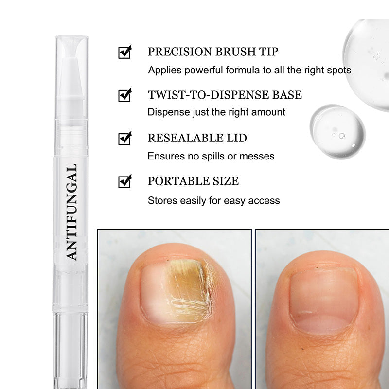 😫 Uñas Amarillas? Lápiz Restaurador, ¡90% Menos Decoloración! ⏳🛡️ 80% Menos Roturas+💧 72h Hidratación!
