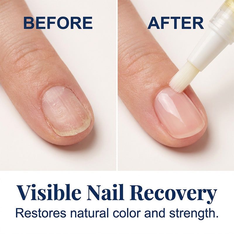 💅✨ ¡OFERTA 50% OFF! Set Restaurador de Uñas – Uñas Más Fuertes y Saludables 💖